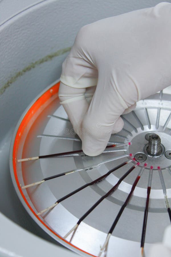 Blood test stock image. Image of laboratory, centrifuge 74888733