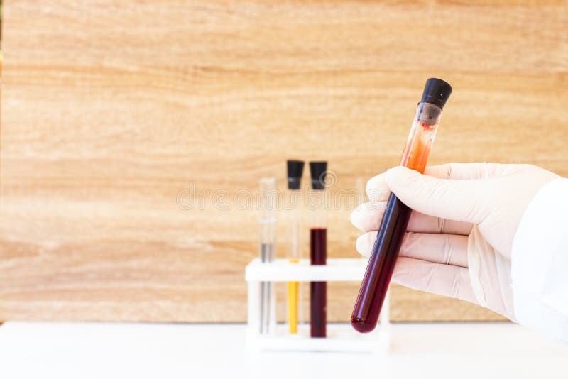 Blood in Test Tubes. Laboratory for Taking Blood Tests. Coronovirus Test Stock Image Image of