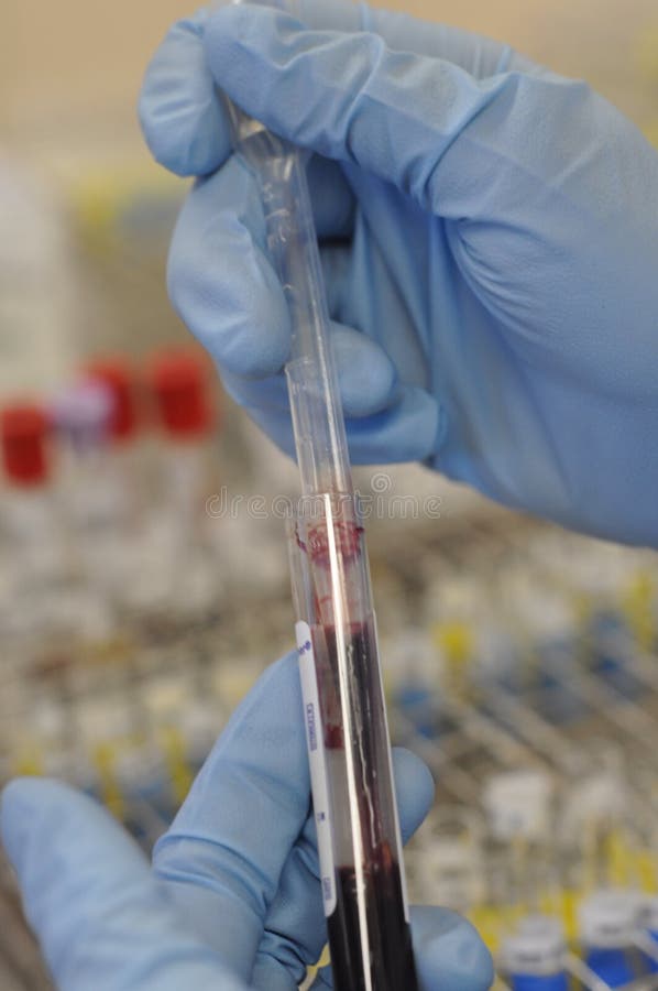 LaboratoryBlood Bank stock image. Image of liquid, pathogen 173975677