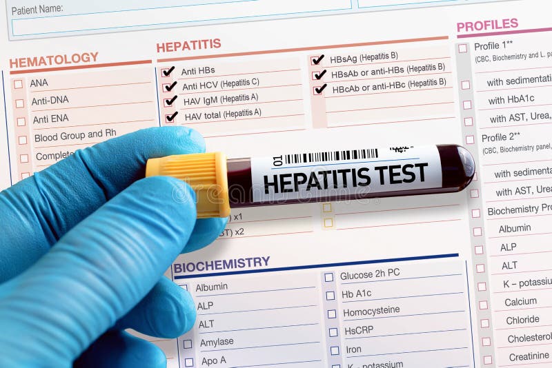 Blood Tube Test with Requisition Report for Hepatitis Test Stock Image