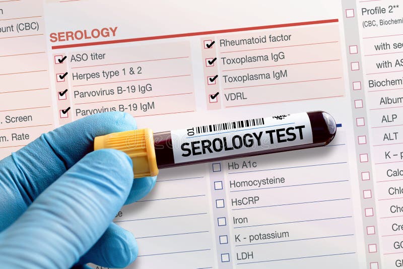 Blood Tube Test with Requisition Report for Serology Test Stock Image