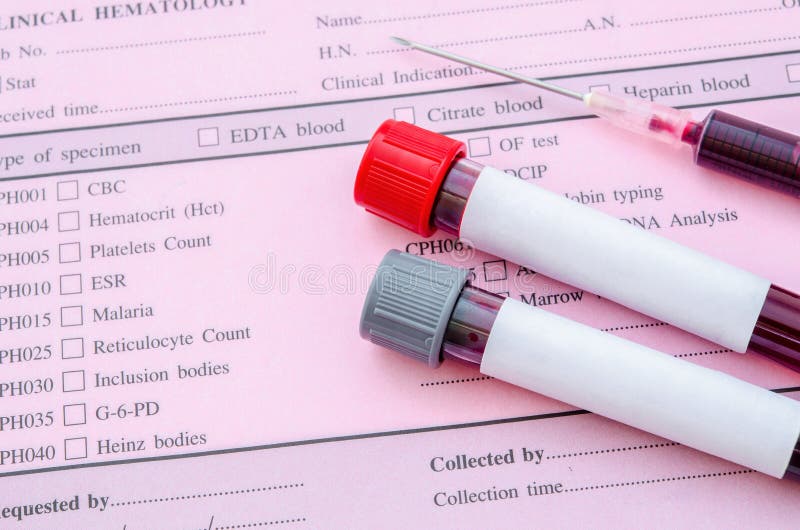 Blood Vial with Blood Sample with Syringe. Stock Image - Image of ...