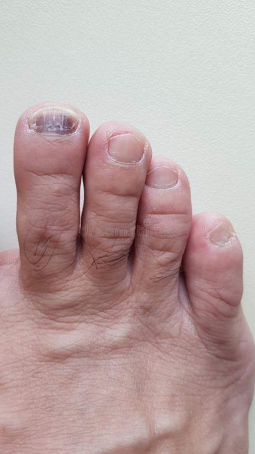 Asian thumb nail