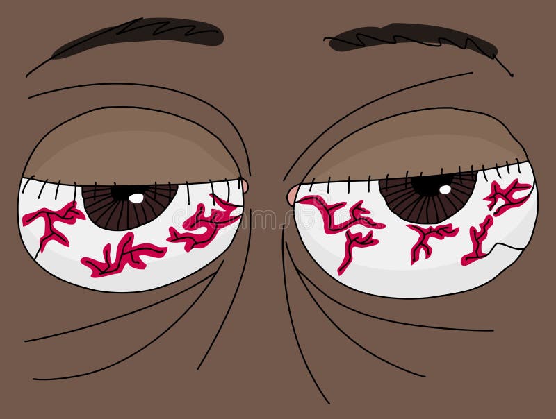 Featured image of post Bloodshot Eye Cartoon 47 images of bloodshot eyes cartoon