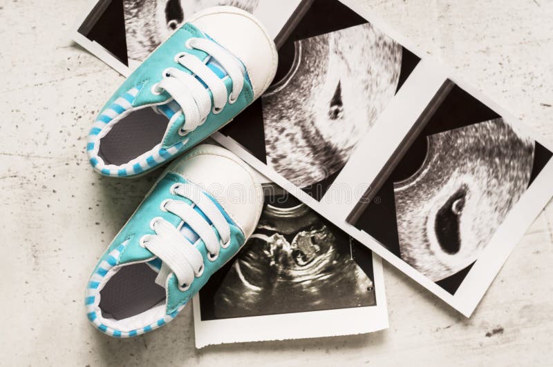 Blue booties next to baby photos with ultrasound at 4 and 20 weeks of pregnancy. baby boy, A son. Selective focus.