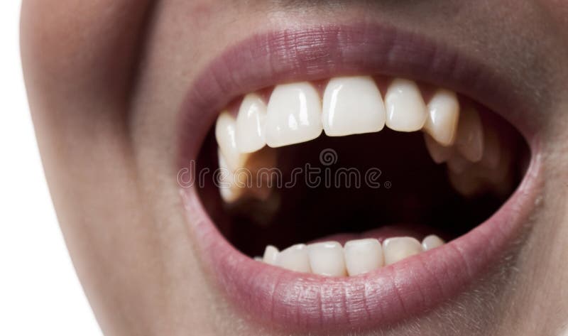 Detalhe de um piercing labret na boca de uma mulher sorridente