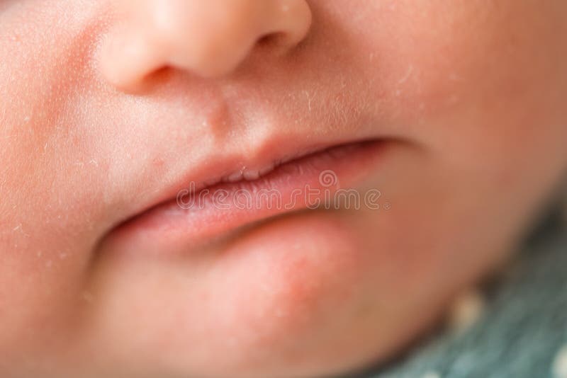 Треугольник вокруг рта. Синева у новорожденного вокруг губ. Белые губы у новорожденного. Синее вокруг губ у новорожденных. Пересохшие губы новорожденный.