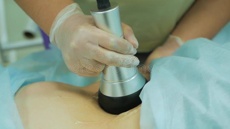 Body cavitation treatment. Hardware cosmetology. Ultrasound cavitation body contouring treatment. Woman getting anti