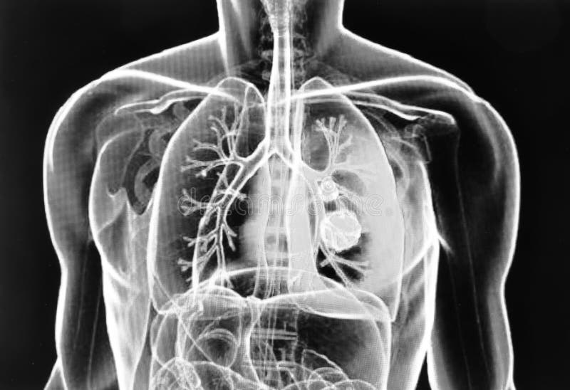 Adult Man with Xray Chest Vision. Radiography Patient Banner. Mockup