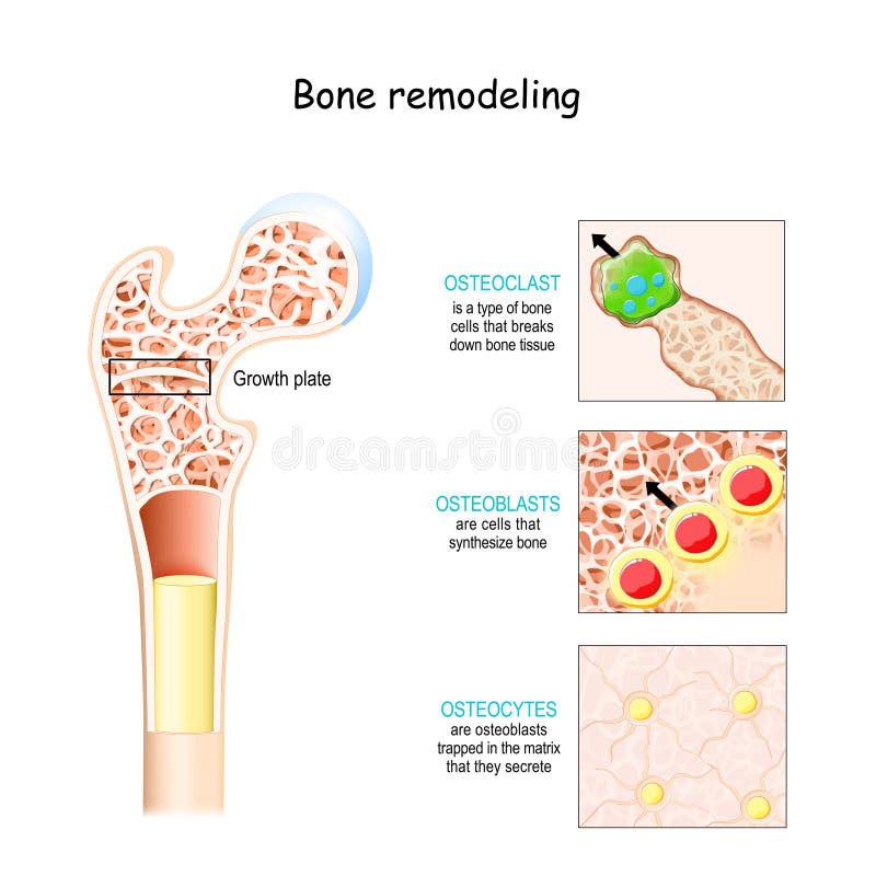 Bone remodeling process. Osteoblast, osteoclast, and osteocyte