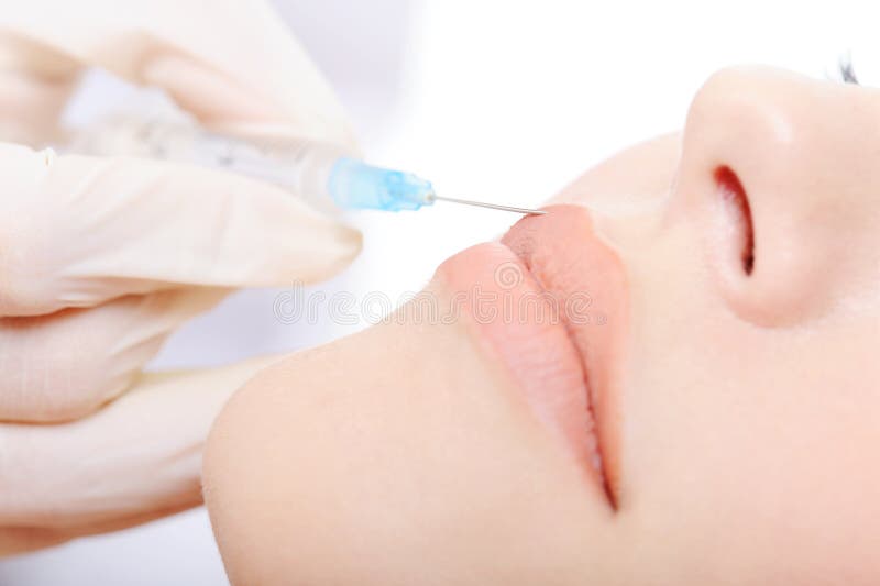 Botox schoss in den Lippen lizenzfreies stockbild Botox schoss in den Lippen lizenzfreies stockbild