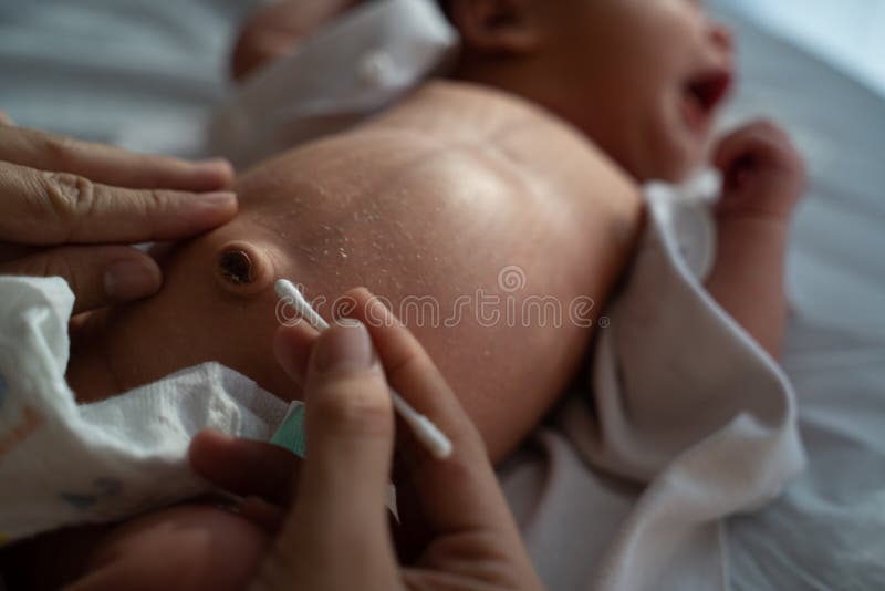 Bebe De Nombril De Nettoyage Photo Stock Image Du Enfant Nourrisson Bebe De Nombril De Nettoyage Photo Stock Image Du Enfant Nourrisson