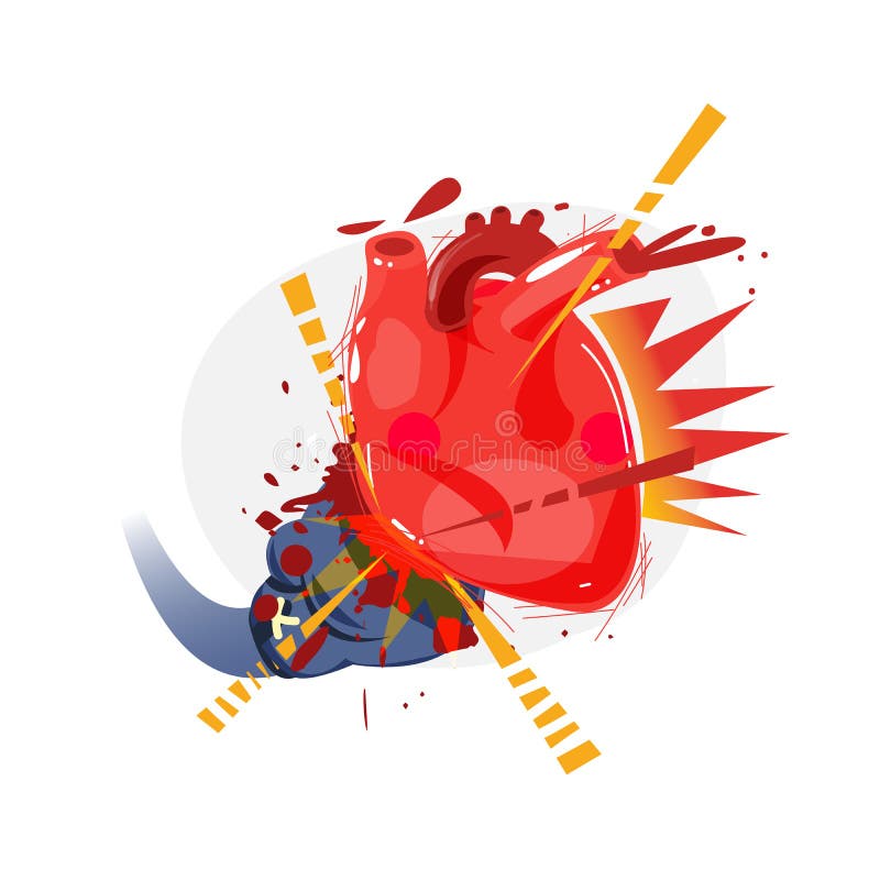 Boxer glove hitting to human heart. heart attack - illustration