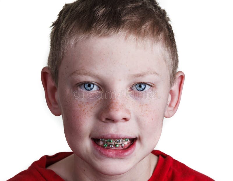 Boy With Braces Royalty Free Stock Photos Image 29172968