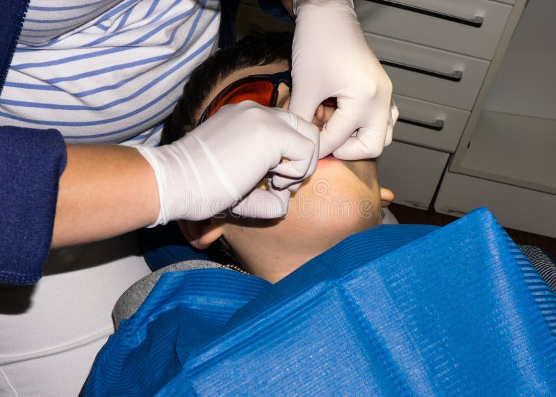 Boy in dental treatment. brace. health care stock photos Boy in dental treatment. brace. health care stock photos