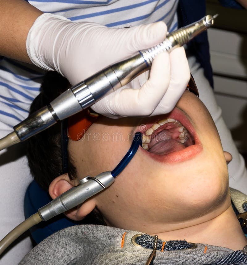 Autistic boy in dental treatment. brace. health care stock images Autistic boy in dental treatment. brace. health care stock images