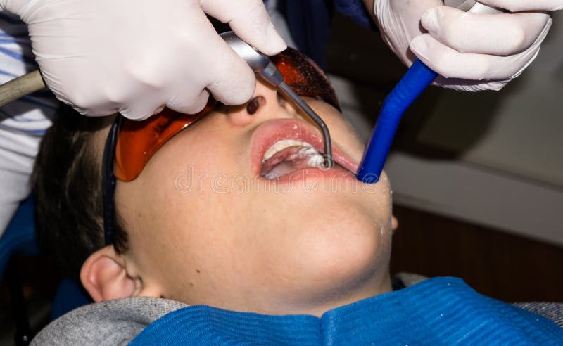 Autistic boy in dental treatment. brace. health care royalty free stock photo Autistic boy in dental treatment. brace. health care royalty free stock photo