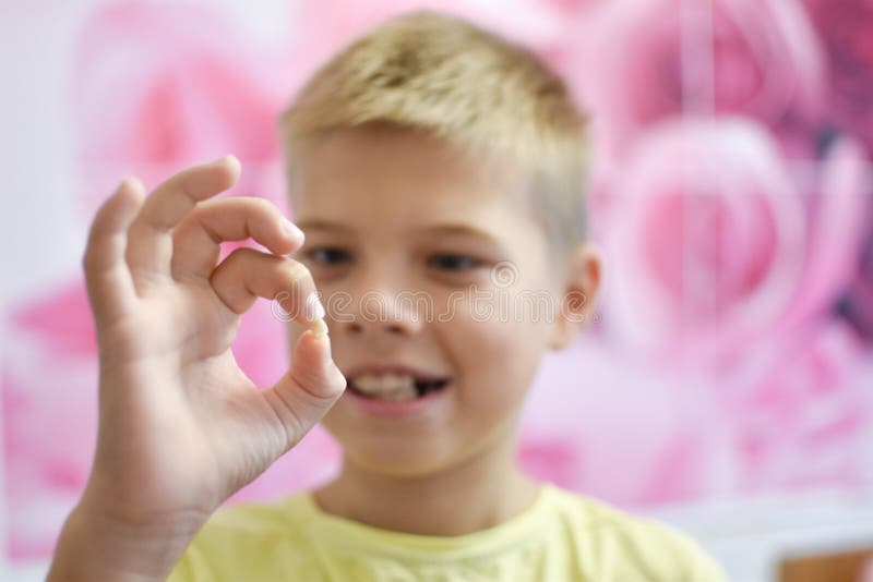 The Boy is Holding a Lost Tooth. Pulling Out a Tooth from a Child Stock
