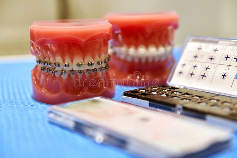 Braces and medical tools stock photo. Image of hygiene 155527832
