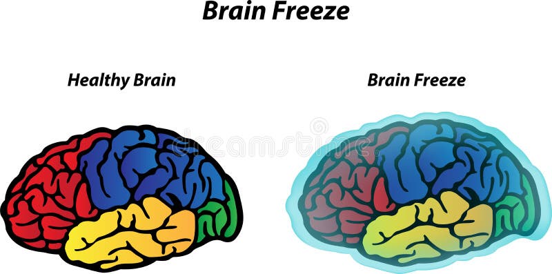 Brain freeze. Растительный мозг. Эффект заморозки мозга. Brain Freeze лексика.