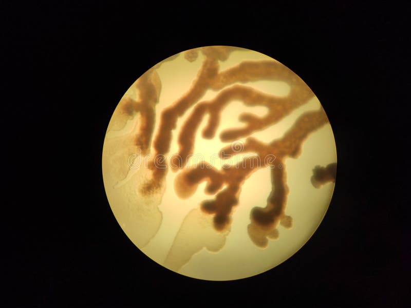 Branched Bacterial Colonies Under the Microscope Stock Image Image of