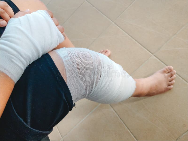 Brazo y pierna del accidente del hombre del fondo de la atención sanitaria con el vendaje Im imágenes de archivo libres de regalías Brazo y pierna del accidente del hombre del fondo de la atención sanitaria con el vendaje Im imágenes de archivo libres de regalías