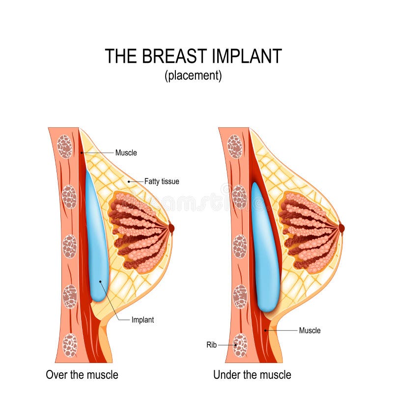 Job pokket boob All Hayley