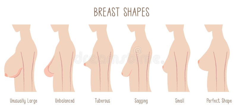 Breast Shape chart stock illustration. Illustration of head - 60363990