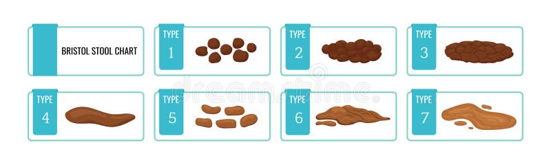 Bristol Stool Chart Scale with Faesces Structure Classification Stock ...