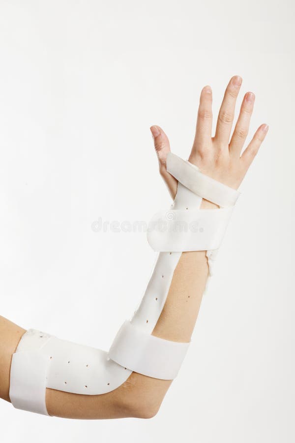 Broken Arm with Brace. Caucasian.White Background Stock Image Image of therapy, broken 50650777