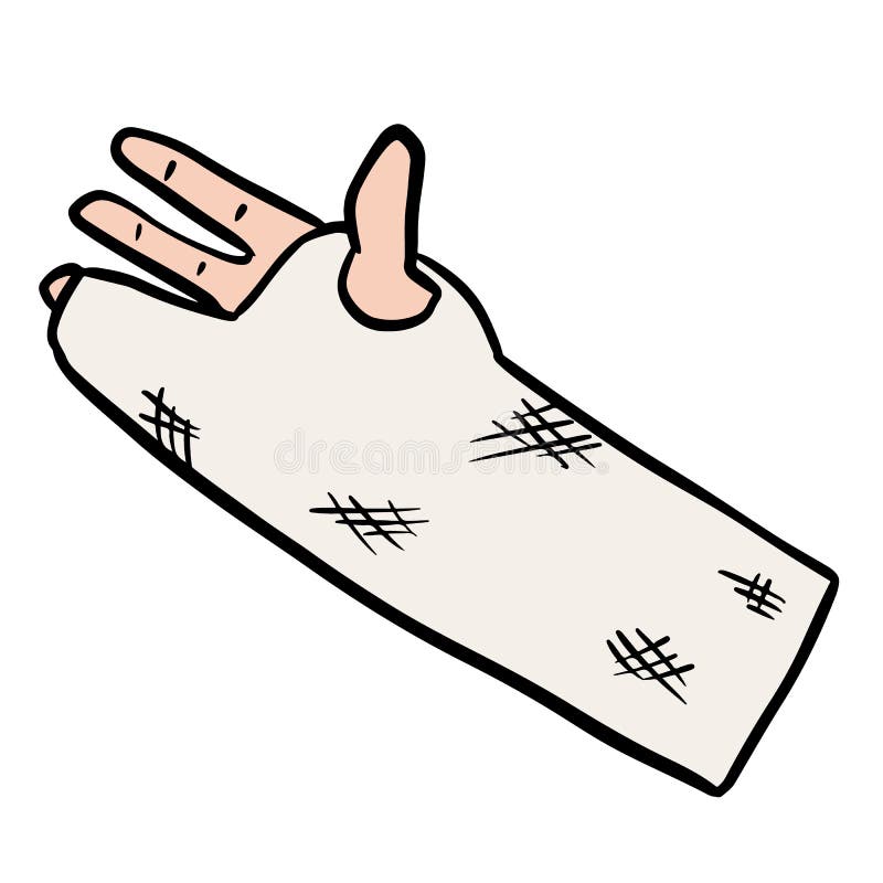 Arm Cast Stock Illustrations 908 Arm Cast Stock Illustrations Vectors Clipart Dreamstime Arm Cast Stock Illustrations 908 Arm Cast Stock Illustrations Vectors Clipart Dreamstime