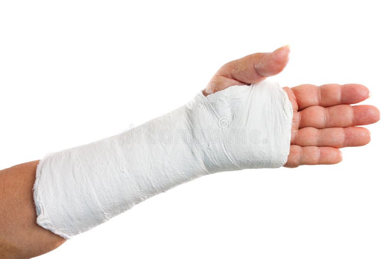 1,471 Broken Hand Cast Royalty-Free Images, Stock Photos