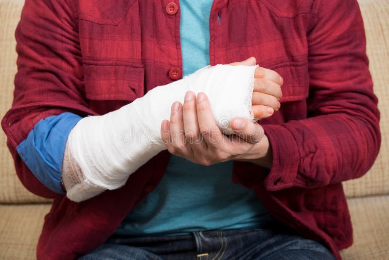 Broken hand royalty free stock photo