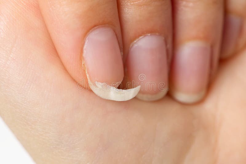 Broken Nail on a Female Hand. Close-up Shoot of Broken Nail. Brittle Fingernail Stock Image - Image of beauty, hygiene: 225016883 Broken Nail on a Female Hand. Close-up Shoot of Broken Nail. Brittle Fingernail Stock Image - Image of beauty, hygiene: 225016883