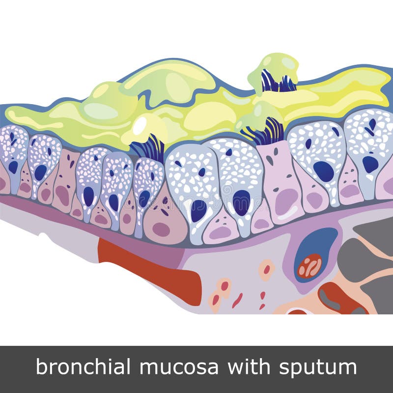 Bronchial Mucosa with Sputum