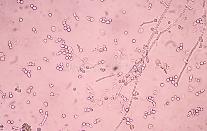 Bacteria 4+ In Urine - all about bacteria images