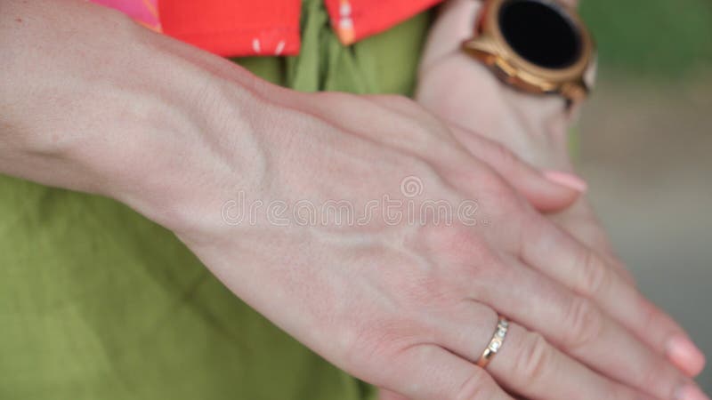 Bulging Veins on Women`s Arms Stock Photo - Image of care, arthritis