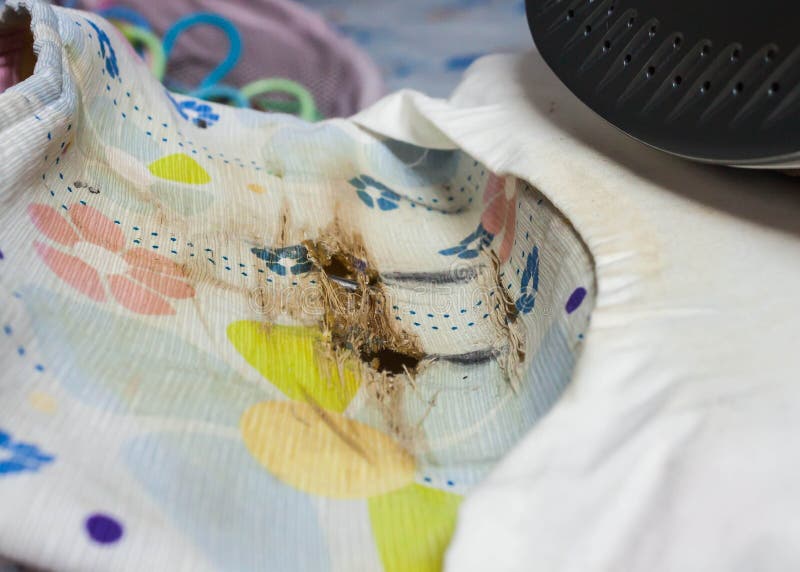 Burn Form Hot Steam, In The Picture It Has Been About A Week And Now