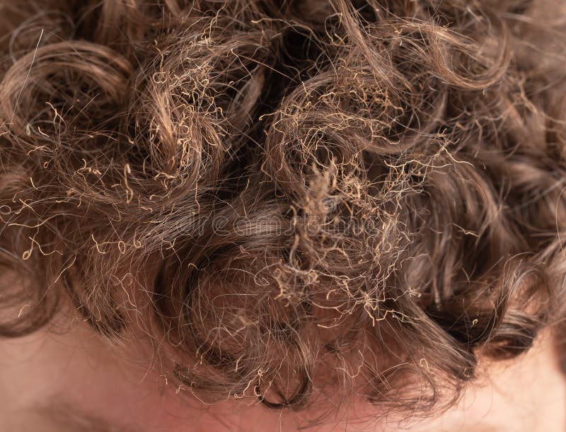 214 Man Burnt Hair Stock Photos - Free & Royalty-Free Stock Photos from Dreamstime 214 Man Burnt Hair Stock Photos - Free & Royalty-Free Stock Photos from Dreamstime