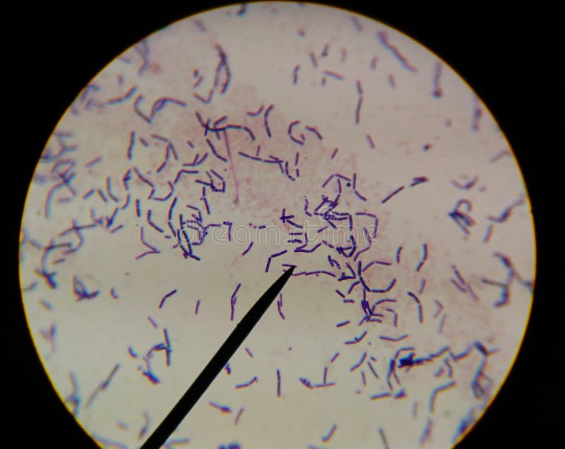 Células De Las Bacterias Que Encuentran Con El Microscopio Imagen de archivo - Imagen de gripe, bacteria: 107153083