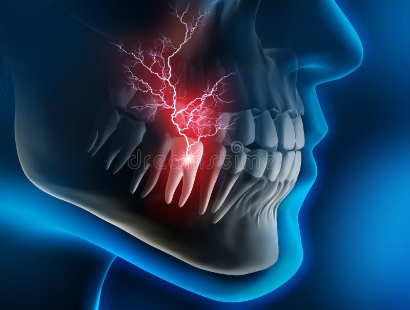 Cabeça e maxila com dor em um dente contra um contexto azul ilustração stock Cabeça e maxila com dor em um dente contra um contexto azul ilustração stock