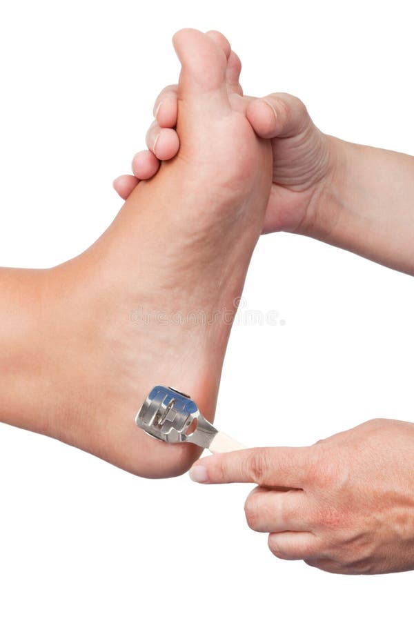 5,424 Callus Stock Photos Free & RoyaltyFree Stock Photos from