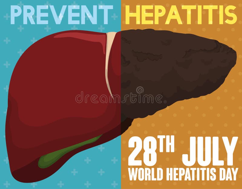 Campagne die Goede en Gezonde Gewoonten voor Lever bevorderen tegen Hepatitis, Vectorillustratie vector illustratie Campagne die Goede en Gezonde Gewoonten voor Lever bevorderen tegen Hepatitis, Vectorillustratie vector illustratie