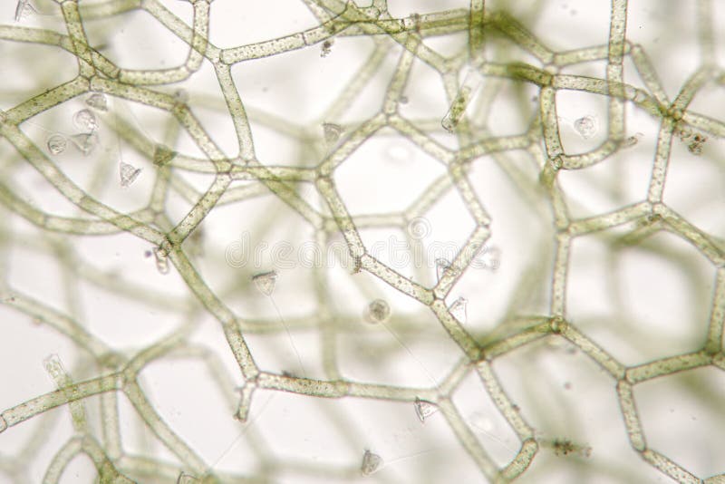 Campânula de água doce da vorticela no reticulatum de Hydrodictyon Fitoplâncton e zooplankton imagens de stock Campânula de água doce da vorticela no reticulatum de Hydrodictyon Fitoplâncton e zooplankton imagens de stock