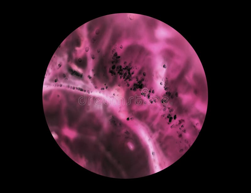 Cancer cell - Wikipedia