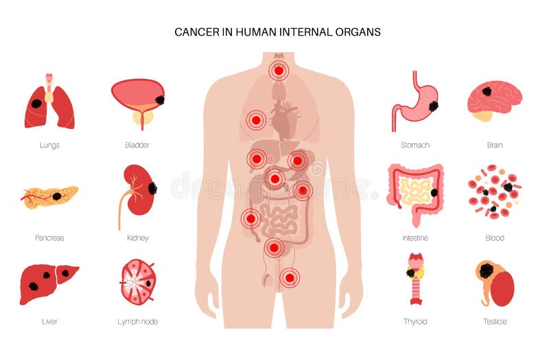 Cancer Icons Set Stock Vector Illustration Of System