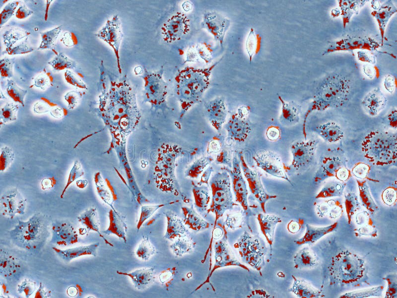 Cancercelllinje arkivbild Cancercelllinje arkivbild