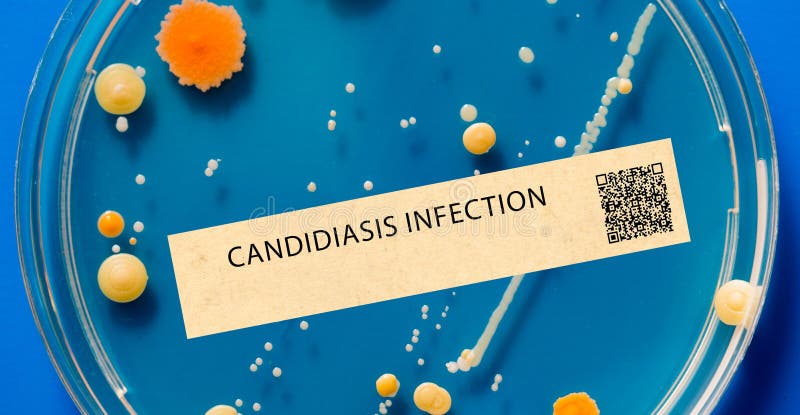 Candidiasis - Fungal infection that can affect the mouth, throat, and genitals stock illustration