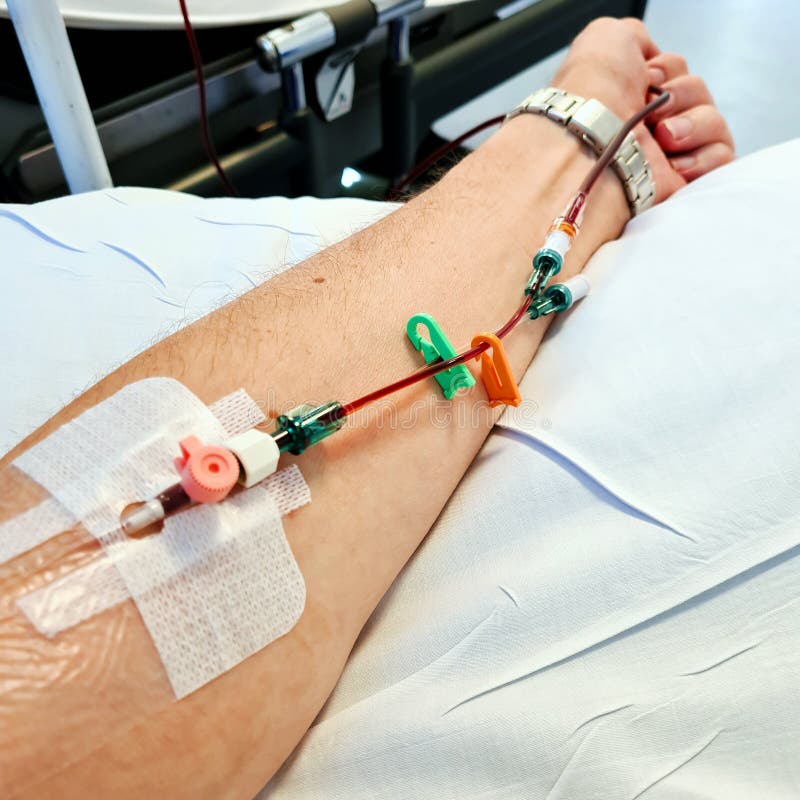 Cannula Ready for Iron Infusion Stock Image Image of hospital
