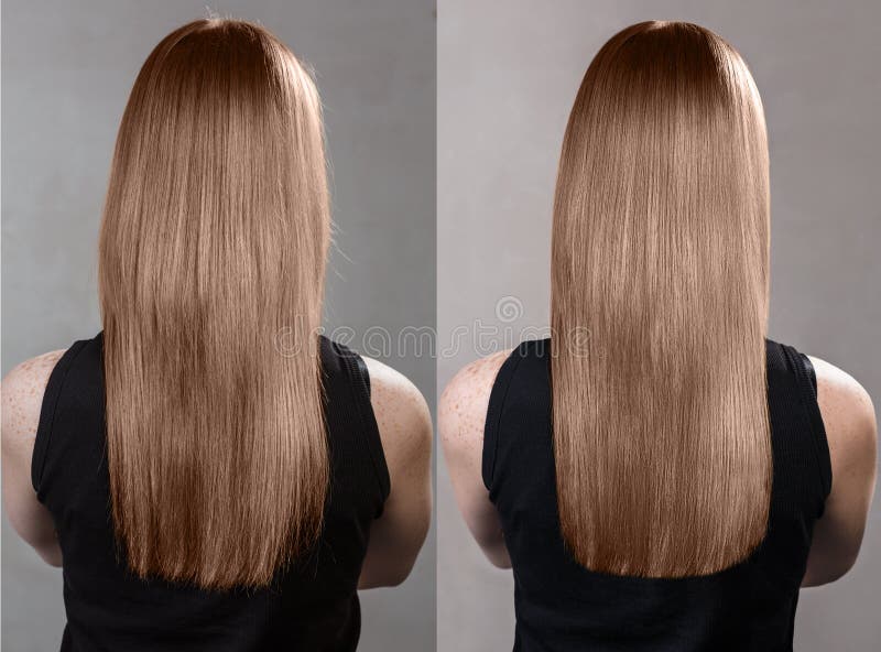 Tintura Capelli Dopo Intervento Chirurgico Alla Testa Capelli Prima E Dopo La Tintura Ed Il Trattamento Immagine Stock